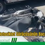 Kazada Motosiklet Sürücüsünün Bacağı Koptu